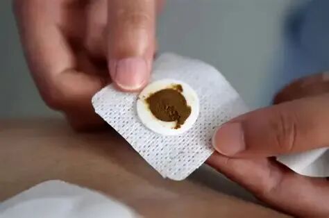 三伏贴要开贴了,你约不约? 三伏贴要开贴了,你约不约?